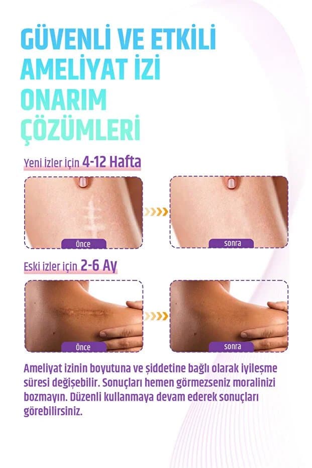 Premium Soft Silikon Yara İz Giderici Bandı %93 Etkili 2’li Set 6m - Keloid/Ameliyat/Sezaryen/Skar