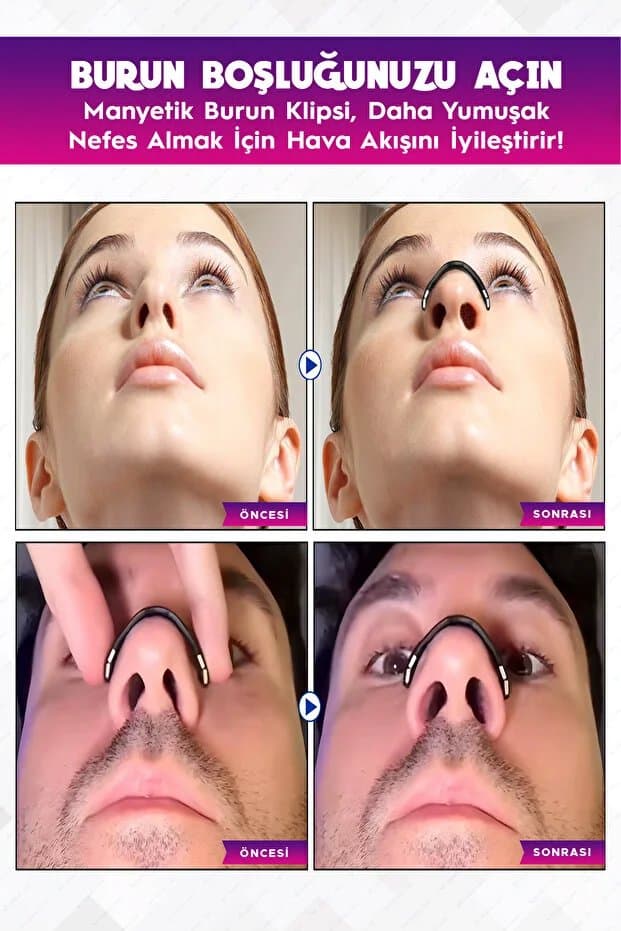 Manyetik Burun Bandı Seti Premium 30'lu, Horlama Azaltıcı Mıknatıslı Siyah Dilatörü Aparatı